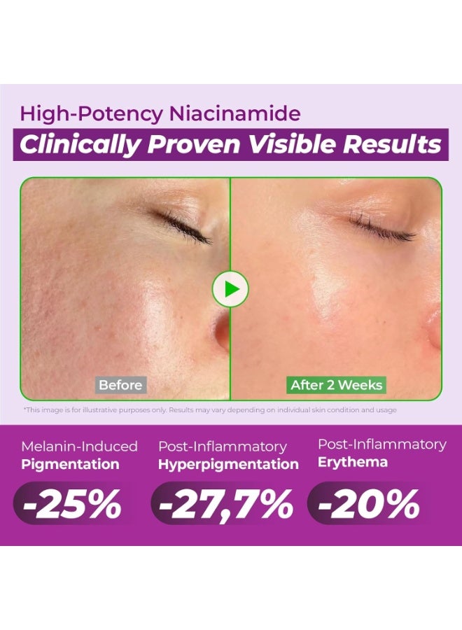 JUMISO Niacinamide 20% Face Serum, Dark Spot & Uneven Tone Care, TXA + Glutathione, Pore & Oil Control for Glass Skin, Centella Soothing, Korean Skincare, 40ml (1.35 fl oz) - Image 4